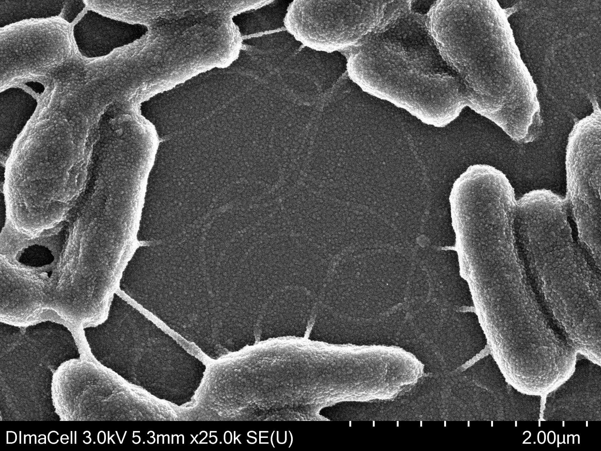 Images de bactéries du sol Chelatobacter heinzi obtenue par MET